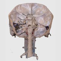 Coronal section - Cranial Nerves exiting the cranial cavity