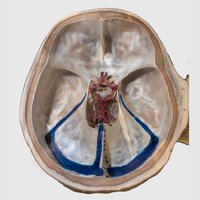 Floor of the Cranial Cavity Showing Circulus Arteriosus and Dural Venous Sinuses