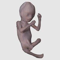 Human Fetus Four Months Old