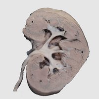Longitudinal section through Kidney