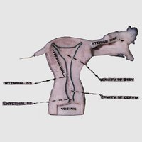 Uterine Cavity